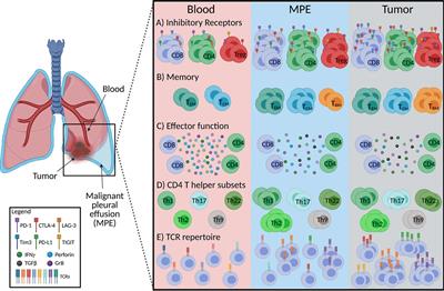 Malignant Pleural Effusions—A Window Into Local Anti-Tumor T Cell Immunity?